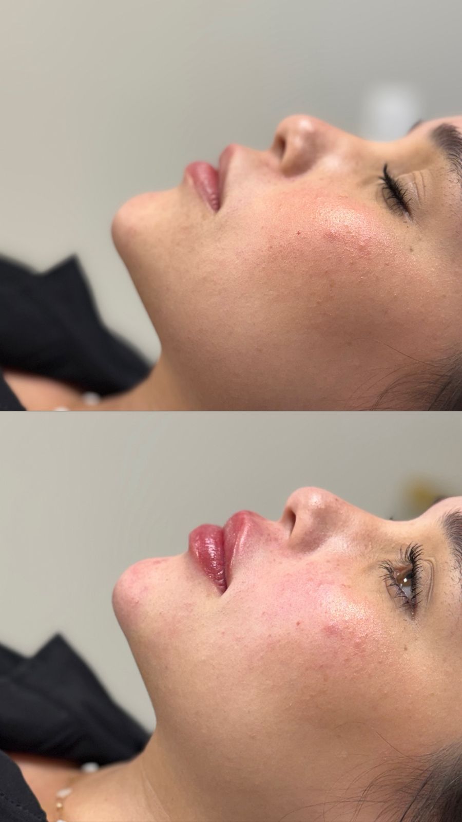 Resultado de atendimento na clínica de estética SENCIÊ em Curitiba