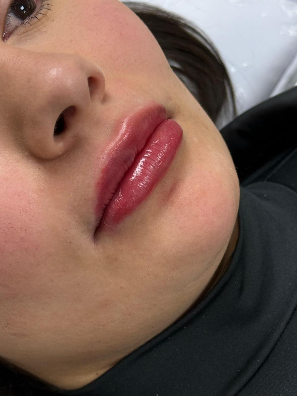 Tratamento facial de rejuvenescimento na clínica SENCIÊ em Curitiba